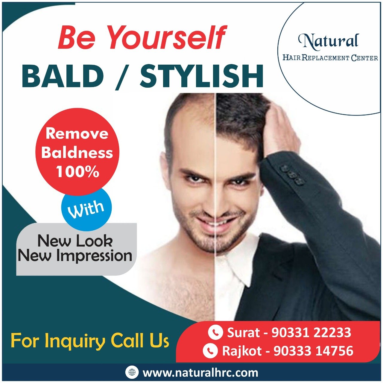 AJ Hair Weaving Centre | Hair transplant | Hair Weaving | Hair Clipping | Hair  Patch | Hair Wig | Hair bonding | In siliguri | Near Me | - Hair  replacement service - Siliguri - West Bengal | Yappe.in